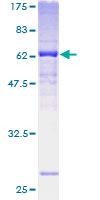 ab161947 on a 12.5% SDS-PAGE stained with Coomassie Blue.