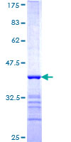ab161575 on a 12.5% SDS-PAGE stained with Coomassie Blue.