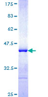 ab166028 on a 12.5% SDS-PAGE stained with Coomassie Blue.
