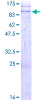 ab162934 on a 12.5% SDS-PAGE stained with Coomassie Blue.