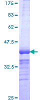 ab162935 on a 12.5% SDS-PAGE stained with Coomassie Blue.