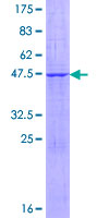 ab165335 on a 12.5% SDS-PAGE stained with Coomassie Blue.