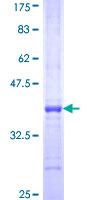 ab165336 on a 12.5% SDS-PAGE stained with Coomassie Blue.
