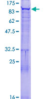 ab162649 on a 12.5% SDS-PAGE stained with Coomassie Blue.