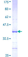 ab162650 on a 12.5% SDS-PAGE stained with Coomassie Blue.