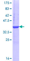 ab165616 on a 12.5% SDS-PAGE stained with Coomassie Blue.