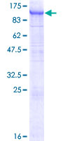 ab162741 on a 12.5% SDS-PAGE stained with Coomassie Blue.