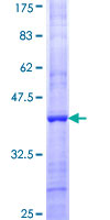 ab162742 on a 12.5% SDS-PAGE stained with Coomassie Blue.
