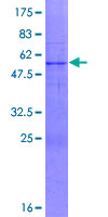 ab164940 on a 12.5% SDS-PAGE stained with Coomassie Blue.