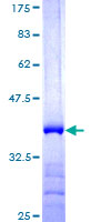 ab164941 on a 12.5% SDS-PAGE stained with Coomassie Blue.