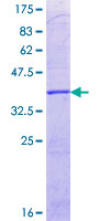 ab165874 on a 12.5% SDS-PAGE stained with Coomassie Blue.