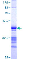 ab161631 on a 12.5% SDS-PAGE stained with Coomassie Blue.