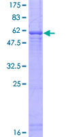 ab161959 on a 12.5% SDS-PAGE stained with Coomassie Blue.