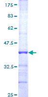 ab161785 on a 12.5% SDS-PAGE stained with Coomassie Blue.