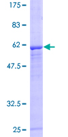 ab161956 on a 12.5% SDS-PAGE stained with Coomassie Blue.