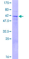 ab161957 on a 12.5% SDS-PAGE stained with Coomassie Blue.