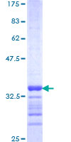 ab161958 on a 12.5% SDS-PAGE stained with Coomassie Blue.