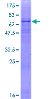 ab166194 on a 12.5% SDS-PAGE stained with Coomassie Blue.