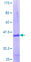ab166195 on a 12.5% SDS-PAGE stained with Coomassie Blue.