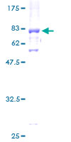 ab161920 on a 12.5% SDS-PAGE stained with Coomassie Blue.