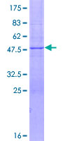 ab162747 on a 12.5% SDS-PAGE stained with Coomassie Blue.