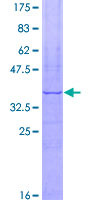 ab162748 on a 12.5% SDS-PAGE stained with Coomassie Blue.