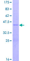 ab164541 on a 12.5% SDS-PAGE stained with Coomassie Blue.