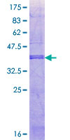 ab164473 on a 12.5% SDS-PAGE stained with Coomassie Blue.
