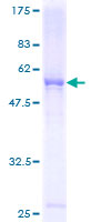 ab160086 on a 12.5% SDS-PAGE stained with Coomassie Blue.