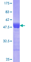 ab160361 on a 12.5% SDS-PAGE stained with Coomassie Blue.
