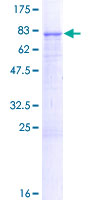 ab165070 on a 12.5% SDS-PAGE stained with Coomassie Blue.