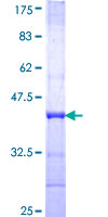 ab165071 on a 12.5% SDS-PAGE stained with Coomassie Blue.