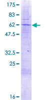 ab165292 on a 12.5% SDS-PAGE stained with Coomassie Blue.
