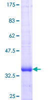 ab165293 on a 12.5% SDS-PAGE stained with Coomassie Blue.
