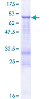 ab164666 on a 12.5% SDS-PAGE stained with Coomassie Blue.