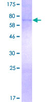 ab158429 on a 12.5% SDS-PAGE stained with Coomassie Blue.