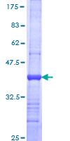 ab158430 on a 12.5% SDS-PAGE stained with Coomassie Blue.