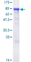 ab160829 on a 12.5% SDS-PAGE stained with Coomassie Blue.