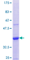 ab160830 on a 12.5% SDS-PAGE stained with Coomassie Blue.