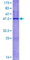 ab165999 on a 12.5% SDS-PAGE stained with Coomassie Blue.