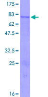 ab158427 on a 12.5% SDS-PAGE stained with Coomassie Blue.