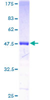 ab158471 on a 12.5% SDS-PAGE stained with Coomassie Blue.