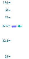 ab158473 on a 12.5% SDS-PAGE stained with Coomassie Blue.