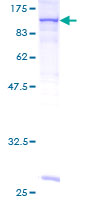 ab158431 on a 12.5% SDS-PAGE stained with Coomassie Blue.