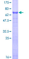 ab157872 on a 12.5% SDS-PAGE stained with Coomassie Blue.