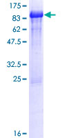 ab162050 on a 12.5% SDS-PAGE stained with Coomassie Blue.