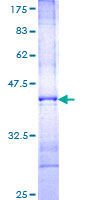 ab158435 on a 12.5% SDS-PAGE stained with Coomassie Blue.