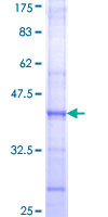 ab160212 on a 12.5% SDS-PAGE stained with Coomassie Blue.