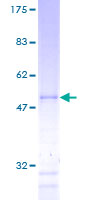 ab160743 on a 12.5% SDS-PAGE stained with Coomassie Blue.