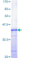 ab158438 on a 12.5% SDS-PAGE stained with Coomassie Blue.